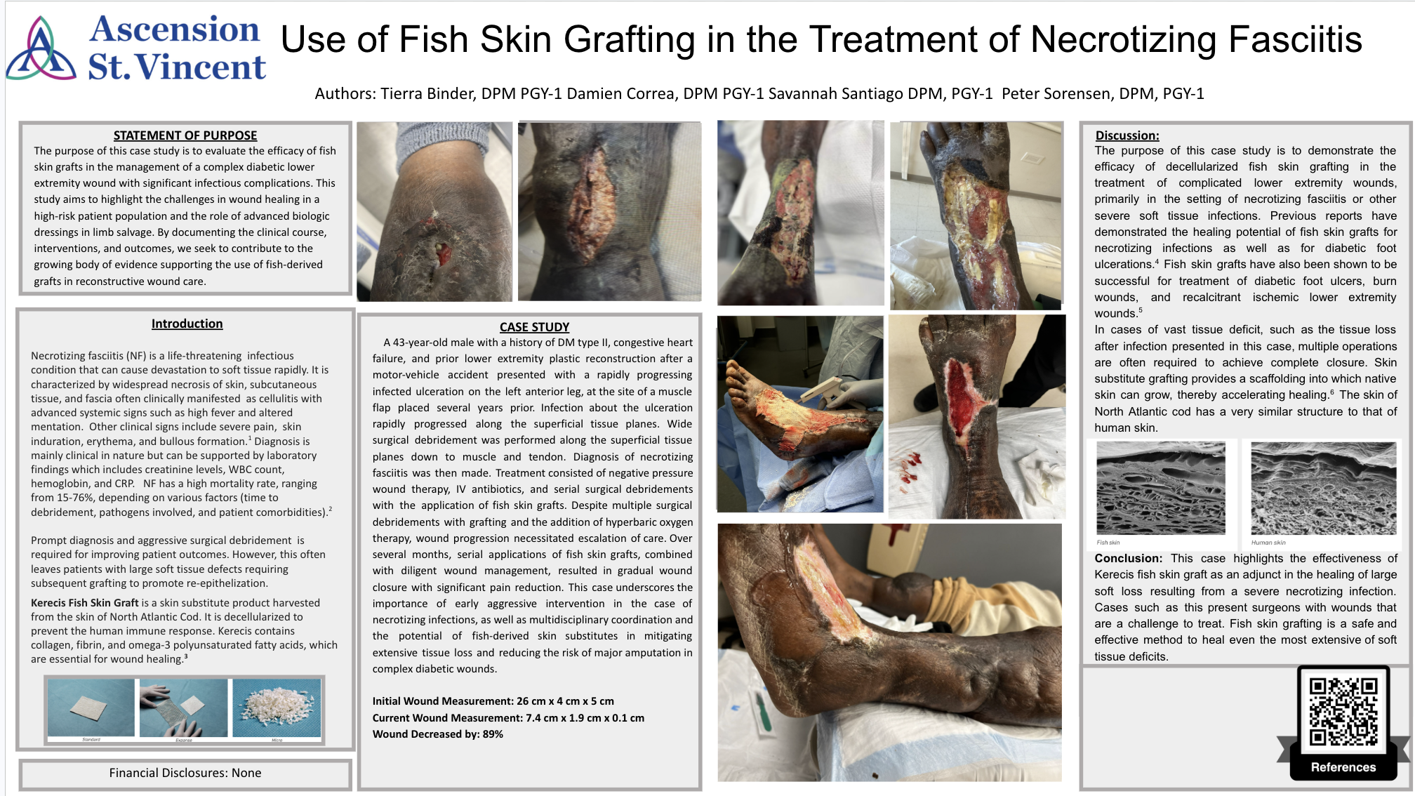 Poster for fish skin grafting in necrotizing fasciitis